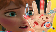 Anna frozen Hand Doctor: Fun Games for Girls Onlin